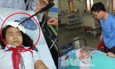 Vụ nữ sinh bị bạn phi dao trúng trán: Bộ GD&ĐT chỉ đạo 'nóng'