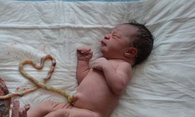 Sinh con “thuận theo tự nhiên” tại nhà: Nguy cơ vỡ tử cung, cả mẹ và con đều tử vong