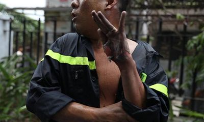 Vụ cháy chung cư Carina: Dân mạng cảm động hình ảnh người lính cứu hỏa bị bỏng lột bàn tay
