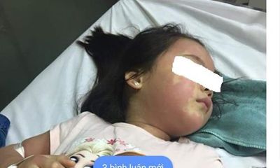 Thực hư vụ bé gái 5 tuổi nổi mẩn khắp người nhập viện cấp cứu nghi do ngộ độc trà sữa