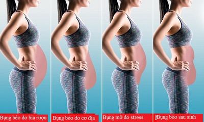 Nguyên nhân của 4 dáng bụng chảy xệ phổ biến nhất và cách khắc phục nhanh chóng