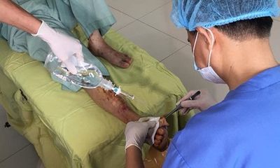 Lười uống thuốc, bệnh nhân tiểu đường phải cắt bỏ ngón chân