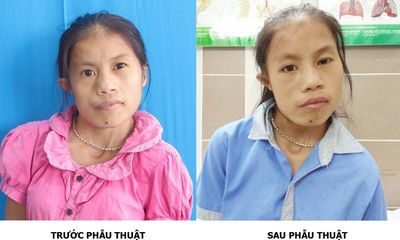 Phép màu xuất hiện sau 20 năm cuộc đời của cô gái trẻ Thái Nguyên