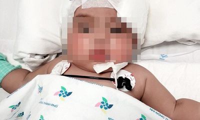 Phòng khám tư chẩn đoán nhầm, bé gái 6 tháng tuổi nguy kịch vì viêm màng não