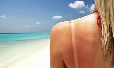 Bí quyết hồi phục hiệu quả tổn thương da do nắng