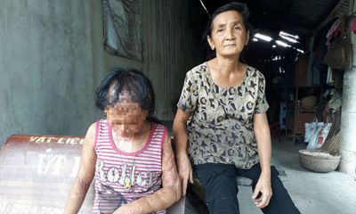 Gia đình tử tù Nguyễn Hữu Tình lên tiếng vụ xin đôi mắt cho bé gái bị tạt axít