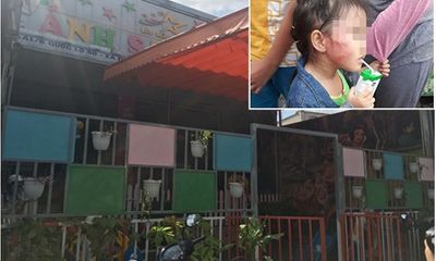 Vụ cô giáo tát bé gái 5 tuổi sưng mặt: Gia đình nạn nhân cầu cứu Hội Bảo vệ quyền trẻ em
