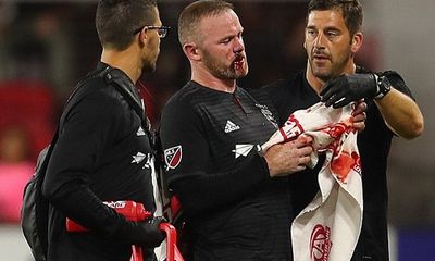 Rooney chảy máu, khâu 5 mũi sau khi ghi bàn thắng đầu tiên cho DC United