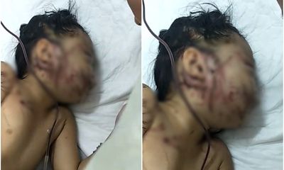 Vụ tai nạn 13 người chết ở Quảng Nam: Tình hình sức khỏe của bé 6 tuổi may mắn sống sót