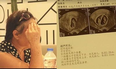 Người phụ nữ mang song thai ở tuổi 67, vẫn quyết sinh dù nguy hiểm đến tính mạng