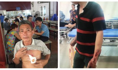 Hà Nội: 5 người cùng nhà bị truy sát phải nhập viện