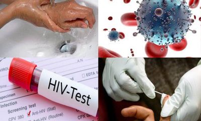 Khi nghi ngờ bị phơi nhiễm HIV cần xử lý như thế nào?