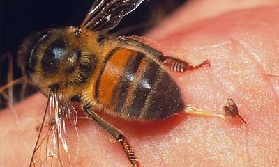 Mẹo làm dịu vết ong đốt không cần thuốc cực kì hiệu quả