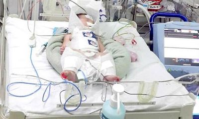 Bác sĩ 3 bệnh viện phối hợp cứu sống bé sơ sinh tổn thương não do mẹ vỡ gan trong lúc chuyển dạ