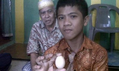 Hé lộ sự thật về cậu bé biết đẻ trứng tại Indonesia