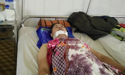 Đắk Lắk: Kẻ trộm xe táo tợn tông bị thương công an viên hòng tẩu thoát