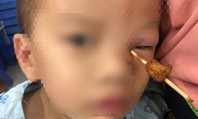 Tin tức đời sống mới nhất ngày 12/9/2018: Bé trai 4 tuổi bị que xiên thịt cắm vào hốc mắt