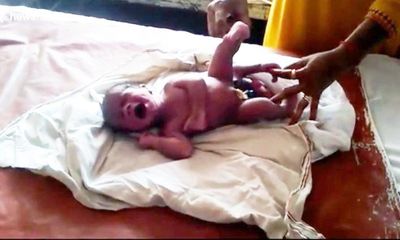 Kỳ lạ cậu bé 4 chân ở Ấn Độ ra đời được gọi là “phép màu Thượng đế”