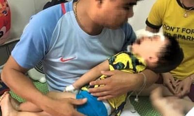 Nghệ An: Bé 2 tuổi bị chó nhà nuôi cắn rách mặt, tổn thương mắt