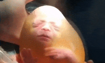 Sửng sốt biểu cảm đáng yêu của em bé sinh ra trong túi ối thu hút triệu lượt xem