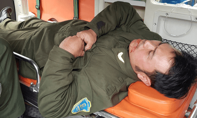 Tin tức thời sự 24h mới nhất ngày 12/1/2019: Nhân viên an ninh sân bay Nội Bài bị cò mồi taxi đánh gãy 4 răng