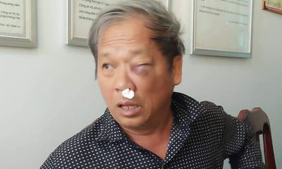 Một nhà báo bị đánh chảy máu mũi, sưng mặt khi đi ăn sáng