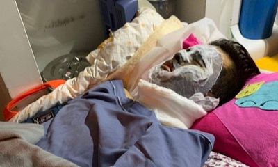 Vụ Việt kiều bị tạt axit, cắt gân chân: Thu giữ lọ axit hung thủ vứt lại hiện trường