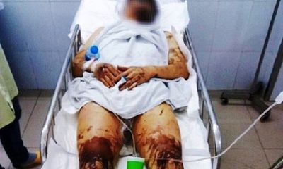 Vụ Việt kiều Canada bị tạt axit, cắt gân chân: Ám ảnh 20 giây gây án của hung thủ