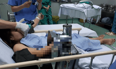 Người phụ nữ nhập viện cấp cứu với cánh tay bị cuốn vào máy xay thịt