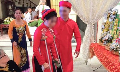 Tin tức đời sống mới nhất ngày 30/3/2019: Cô dâu số nhọ bị ngã gãy chân ngay trước ngày cưới