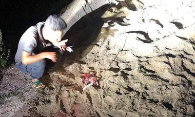 Hưng Yên: Cháu bé 7 tuổi bị đàn chó tấn công đã tử vong