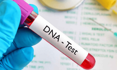 Xét nghiệm ADN xác định huyết thống với độ chính xác cao