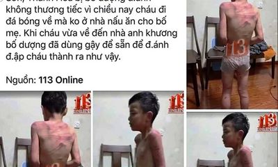 Xác minh thông tin bé trai bị cha dượng bạo hành dã man ở Thanh Hóa