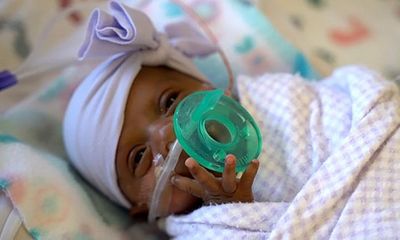 Em bé sơ sinh nhỏ nhất thế giới, nặng hơn 200 gram vẫn sống sót kỳ diệu