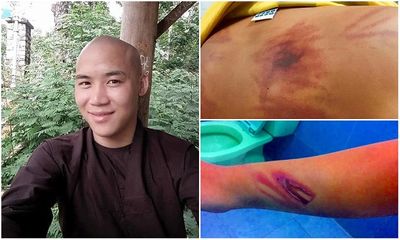 Công an thông tin vụ thầy tu đánh bé trai 11 tuổi dã man ở Bình Thuận