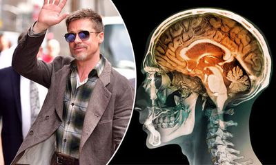 Mang tiếng ngạo mạn bao năm, Brad Pitt thú nhận do mắc bệnh nguy hiểm