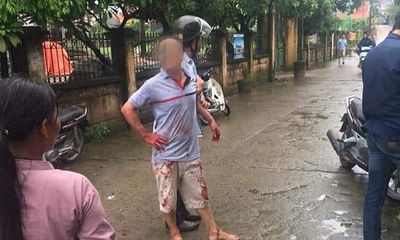 Vụ anh chém 5 người gia đình em ruột thương vong ở Hà Nội: Nghi can có thể đối diện mức án tử hình