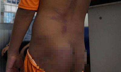 4 trẻ nghi bị bạo hành thâm tím khắp người ở Cà Mau được phát hiện như thế nào?