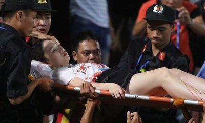 Nữ cổ động viên bị trúng pháo sáng trên sân Hàng Đẫy: 