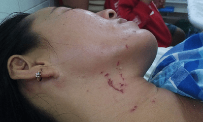 Vụ chồng đánh đập vợ từ dưới nước lên tận bờ ở Tây Ninh: Lời kể cay đắng của người vợ