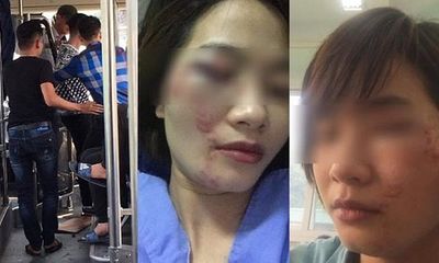 Hà Nội: Nữ nhân viên phụ xe buýt bị 4 thanh niên hành hung đúng ngày 20/10