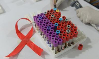 Chủng mới đầu tiên của HIV lần đầu được phát hiện sau gần 20 năm