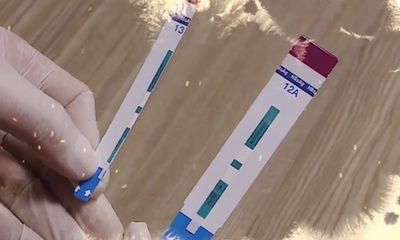 3 cán bộ bệnh viện Xanh Pôn bị đình chỉ sau vụ cắt đôi que thử HIV, viêm gan B