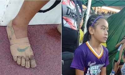 Nghị lực phi thường của bé gái 11 tuổi giành 3 huy chương vàng chỉ với băng dính quấn quanh chân
