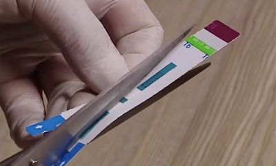 Vụ cắt đôi que thử HIV, viêm gan B ở bệnh viện Xanh Pôn: Phó khoa vi sinh là 
