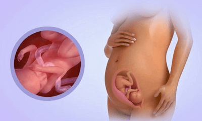 Sự phát triển của thai nhi tuần 21 mẹ bầu nên biết 