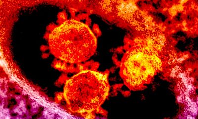 Úc ghi nhận trường hợp thứ 5 mắc bệnh viêm phổi lạ