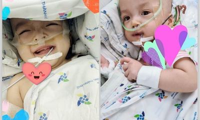 Tin tức đời sống mới nhất ngày 30/7/2020: Hai bé song Nhi đã cai máy thở, sức khoẻ ổn định