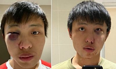 Thủ phạm hành hung du học sinh người Singapore vì kỳ thị đã nhận tội
