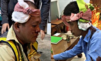 Vụ 2 nhân viên Trạm BOT Ninh Xuân bị đánh nhập viện: Nạn nhân tiết lộ nguyên nhân